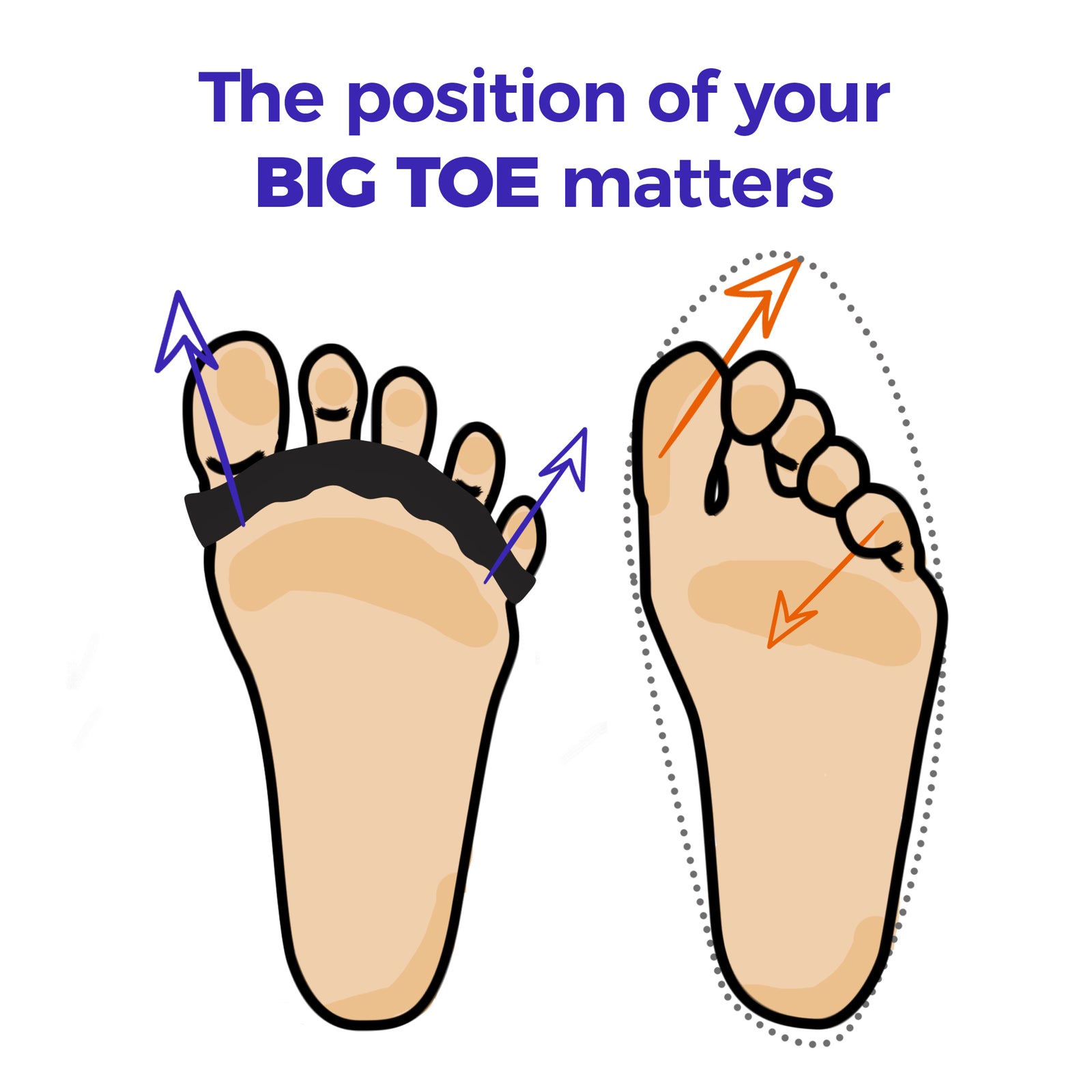Why Toe Spacers?
